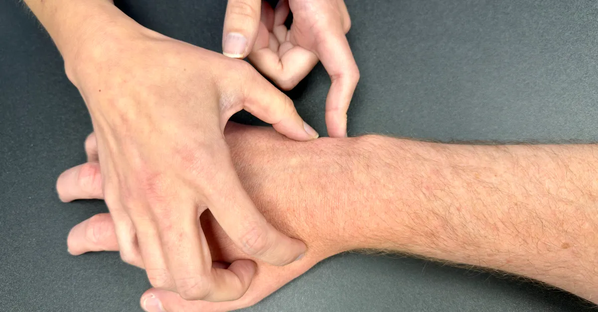 Consultant Hand Therapist Ms Razo examining the ulnar side of a patient's wrist